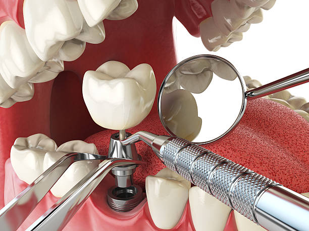 Best Emergency Treatment for Oral Infections in Edgewater, FL
