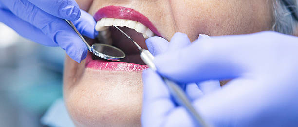 Best Broken or Chipped Tooth Repair in Edgewater, FL